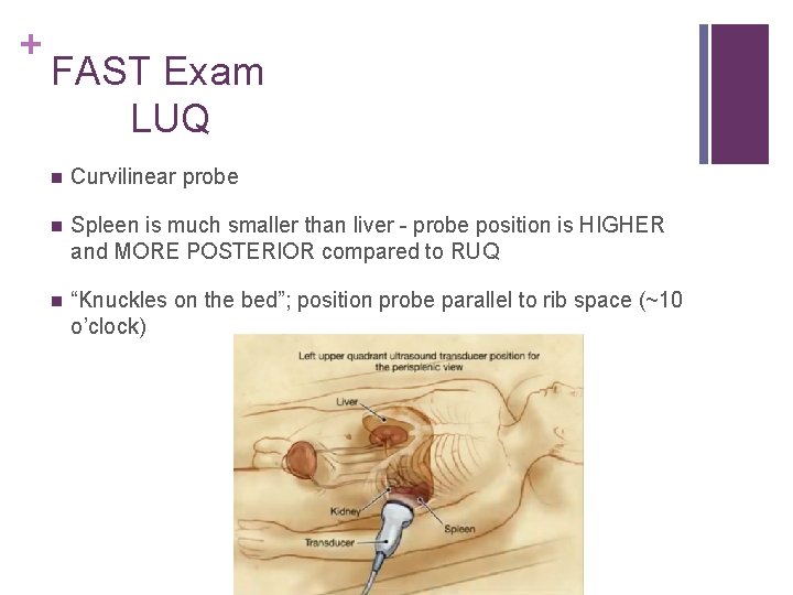 + FAST Exam LUQ n Curvilinear probe n Spleen is much smaller than liver