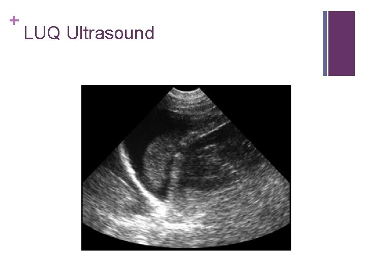 + LUQ Ultrasound 