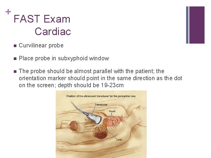 + FAST Exam Cardiac n Curvilinear probe n Place probe in subxyphoid window n