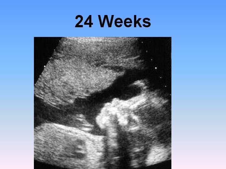 24 Weeks 