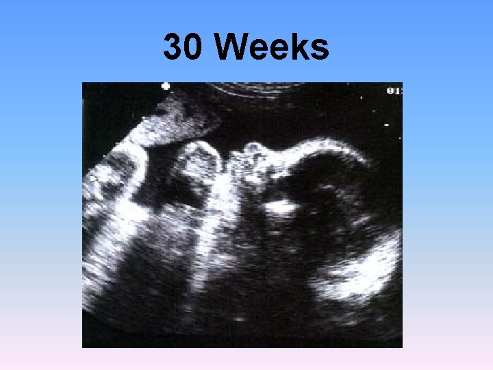 30 Weeks 