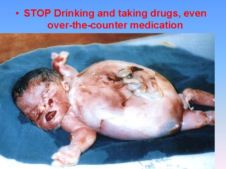  • STOP Drinking and taking drugs, even over-the-counter medication 