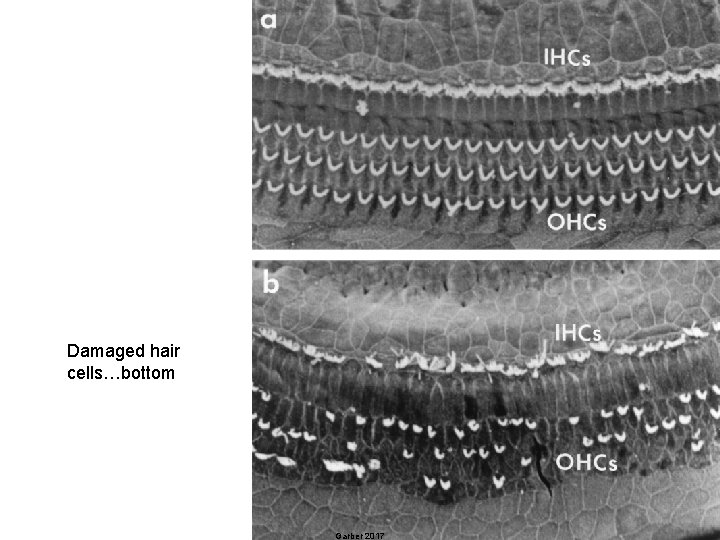 Damaged hair cells…bottom 23 Garber 2017 