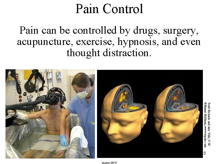 Pain Control Pain can be controlled by drugs, surgery, acupuncture, exercise, hypnosis, and even