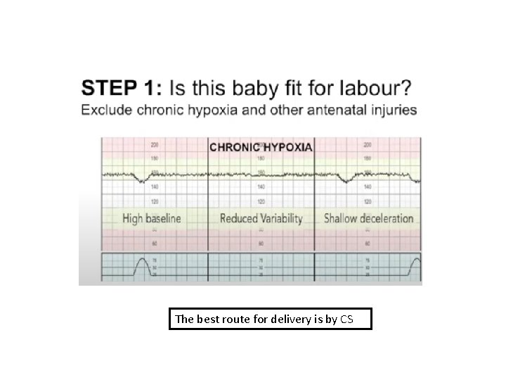 The best route for delivery is by CS 