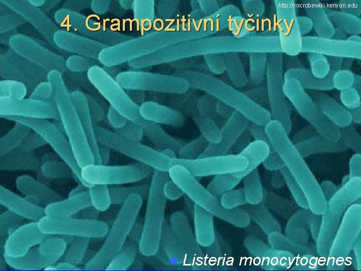 http: //microbewiki. kenyon. edu 4. Grampozitivní tyčinky l Listeria monocytogenes 