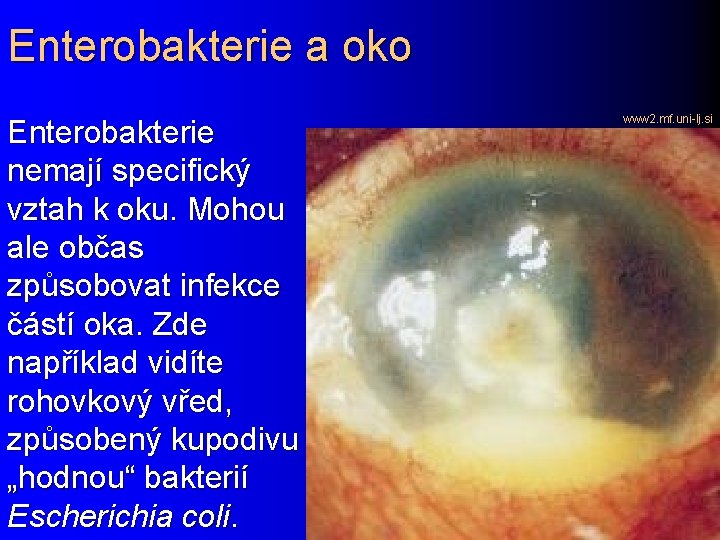 Enterobakterie a oko Enterobakterie nemají specifický vztah k oku. Mohou ale občas způsobovat infekce
