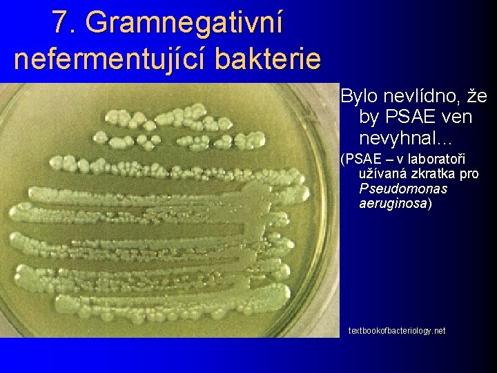 7. Gramnegativní nefermentující bakterie Bylo nevlídno, že by PSAE ven nevyhnal… (PSAE – v
