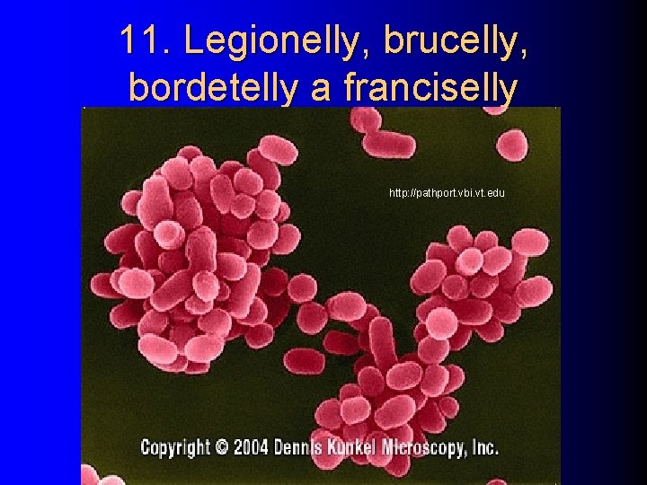 11. Legionelly, brucelly, bordetelly a franciselly http: //pathport. vbi. vt. edu 