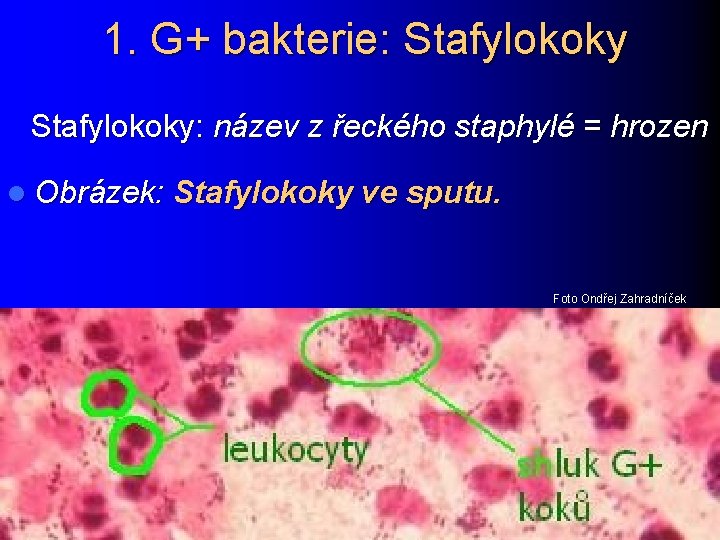 1. G+ bakterie: Stafylokoky: název z řeckého staphylé = hrozen l Obrázek: Stafylokoky ve