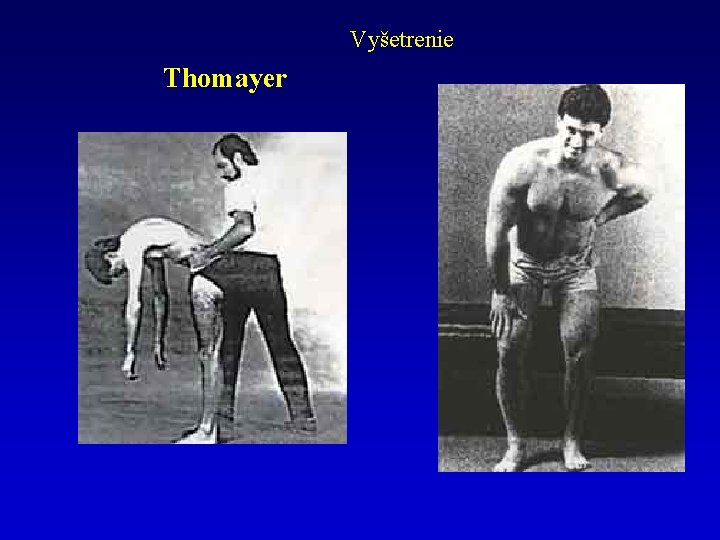 Vyšetrenie Thomayer 