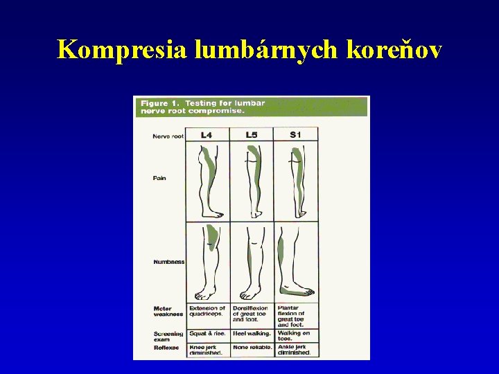 Kompresia lumbárnych koreňov 