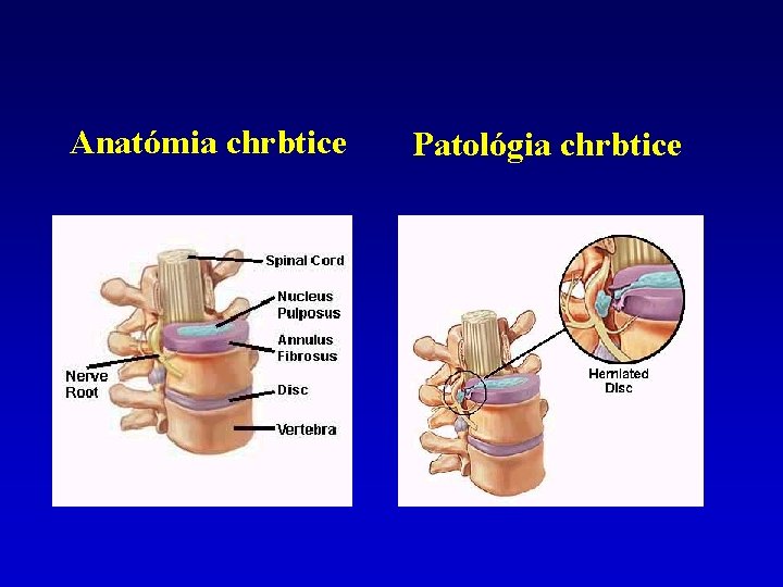 Anatómia chrbtice Patológia chrbtice 