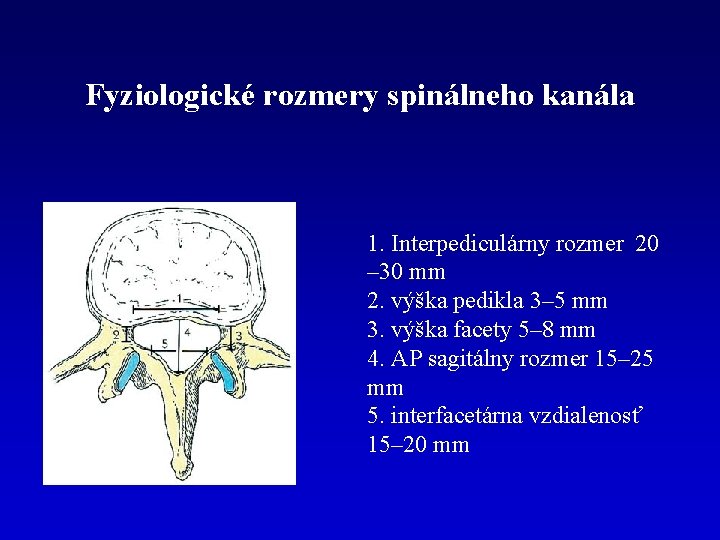 Fyziologické rozmery spinálneho kanála 1. Interpediculárny rozmer 20 – 30 mm 2. výška pedikla