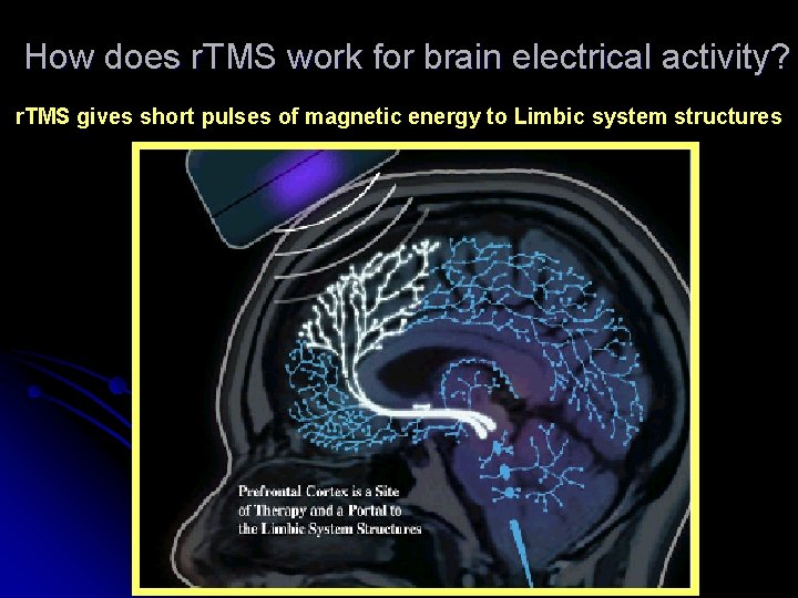 How does r. TMS work for brain electrical activity? r. TMS gives short pulses