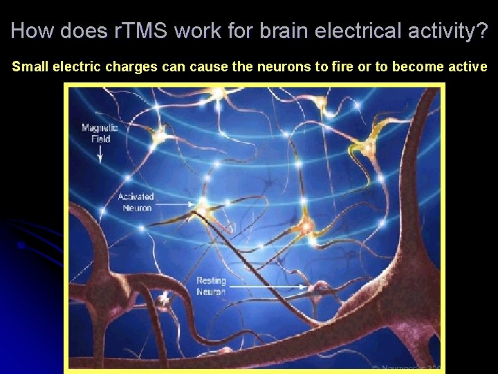 How does r. TMS work for brain electrical activity? Small electric charges can cause