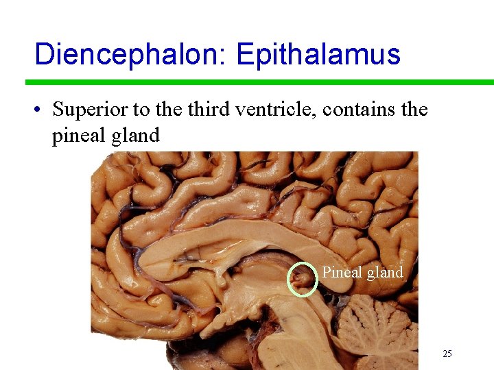 Diencephalon: Epithalamus • Superior to the third ventricle, contains the pineal gland Pineal gland