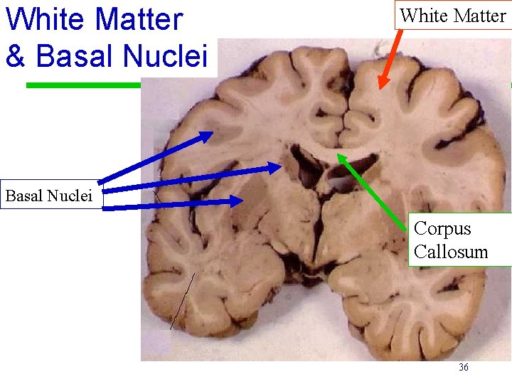 White Matter & Basal Nuclei White Matter Basal Nuclei Corpus Callosum 36 