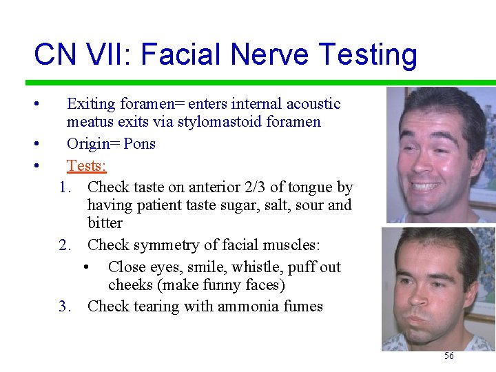 CN VII: Facial Nerve Testing • • • Exiting foramen= enters internal acoustic meatus