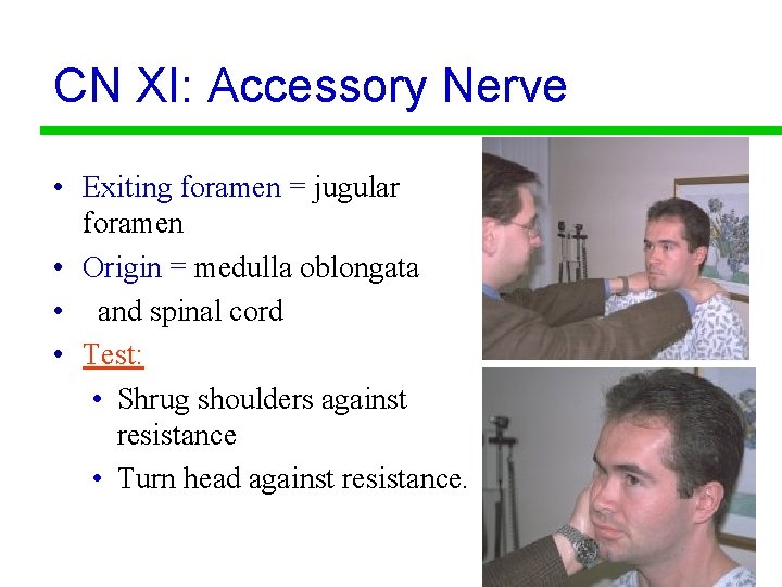 CN XI: Accessory Nerve • Exiting foramen = jugular foramen • Origin = medulla