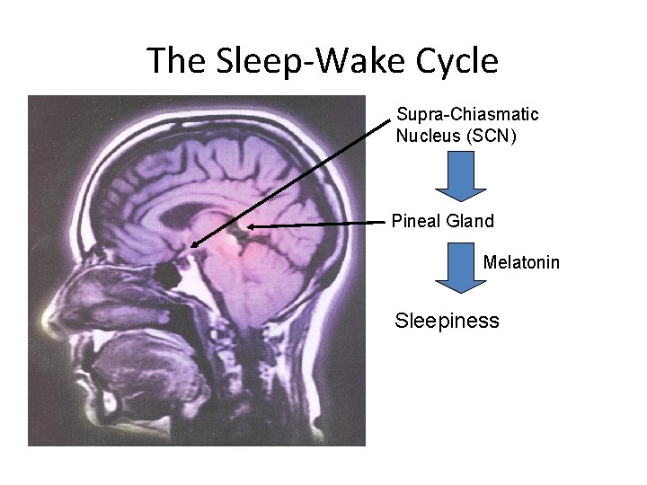 The Sleep-Wake Cycle Supra-Chiasmatic Nucleus (SCN) Pineal Gland Melatonin Sleepiness 