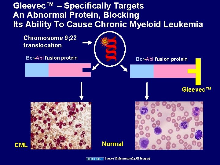 Gleevec™ – Specifically Targets An Abnormal Protein, Blocking Its Ability To Cause Chronic Myeloid