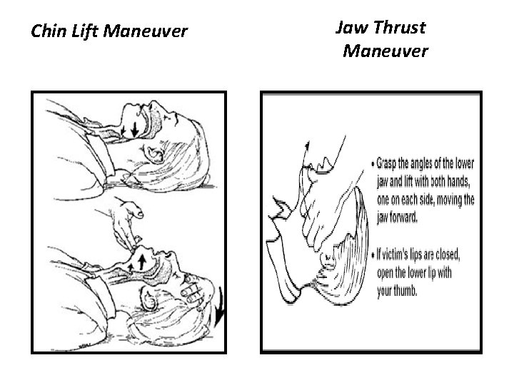 oroand nasopharyngeal airways By ishraq arabiat Objectives Oropharyngeal