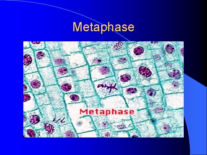 Metaphase 
