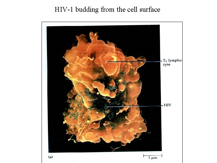 HIV-1 budding from the cell surface 