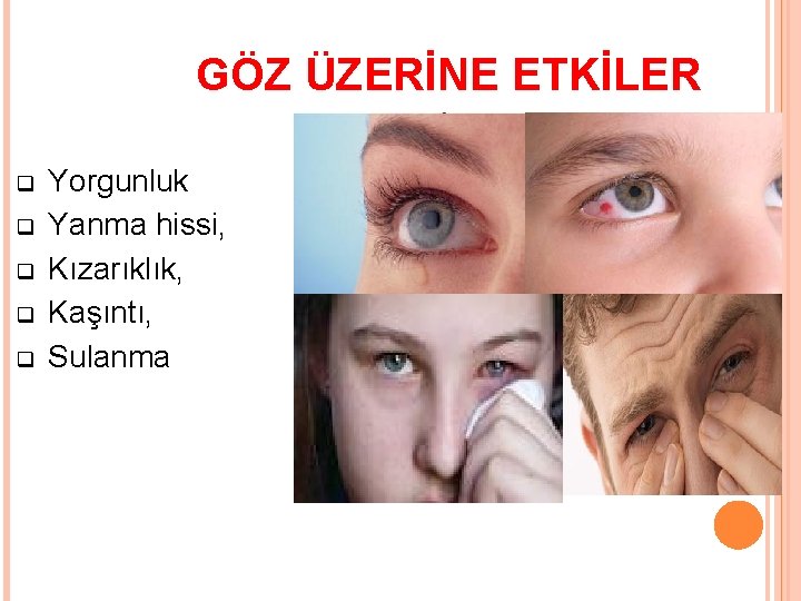 GÖZ ÜZERİNE ETKİLER q q q Yorgunluk Yanma hissi, Kızarıklık, Kaşıntı, Sulanma 