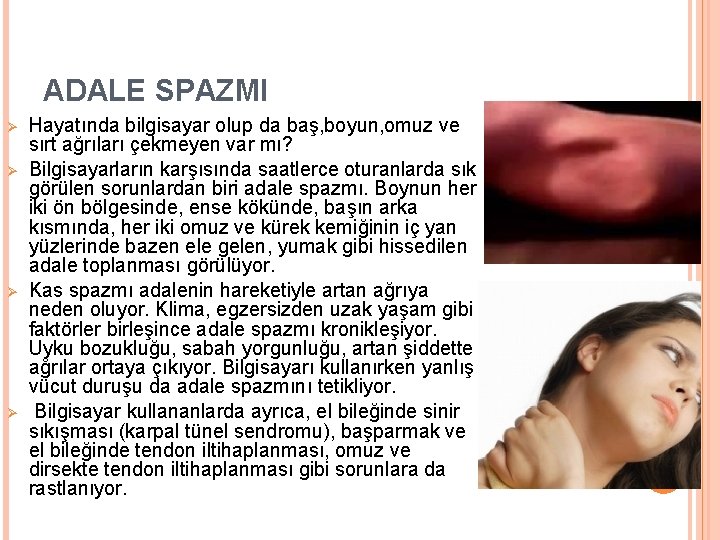 ADALE SPAZMI Ø Ø Hayatında bilgisayar olup da baş, boyun, omuz ve sırt ağrıları