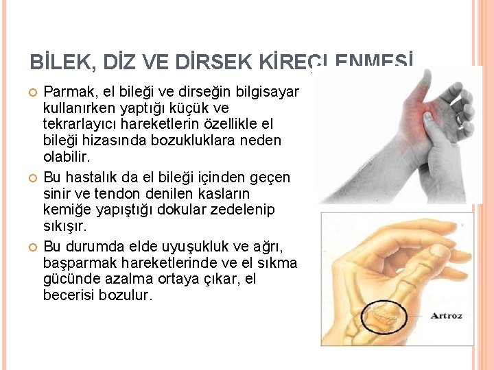 BİLEK, DİZ VE DİRSEK KİREÇLENMESİ Parmak, el bileği ve dirseğin bilgisayar kullanırken yaptığı küçük