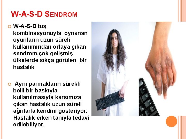 W-A-S-D SENDROM W-A-S-D tuş kombinasyonuyla oynanan oyunların uzun süreli kullanımından ortaya çıkan sendrom, çok