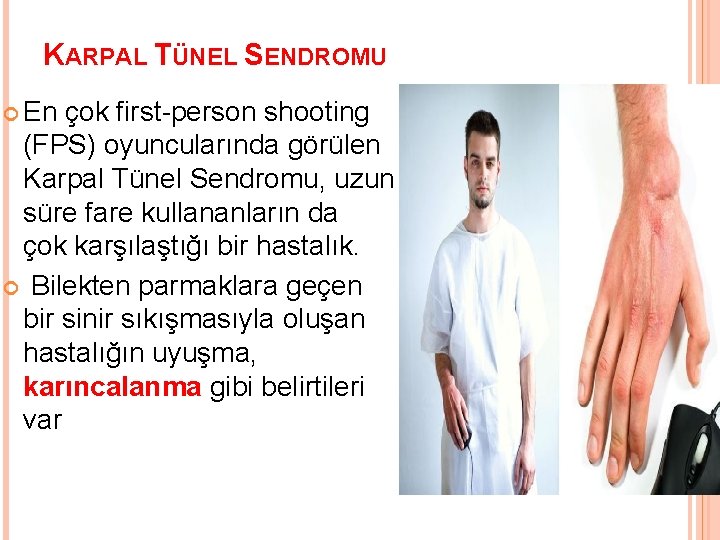 KARPAL TÜNEL SENDROMU En çok first-person shooting (FPS) oyuncularında görülen Karpal Tünel Sendromu, uzun