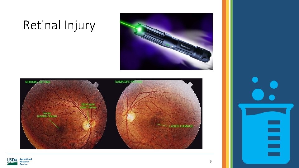 Retinal Injury 9 