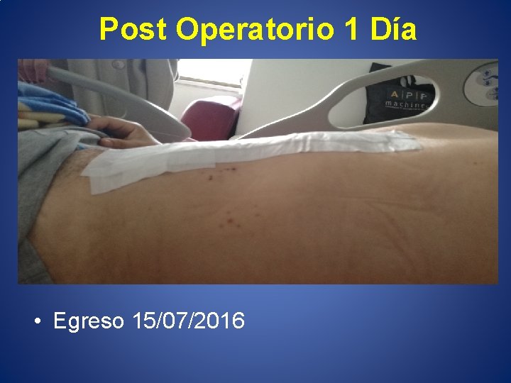 Post Operatorio 1 Día • Egreso 15/07/2016 