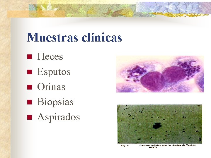 Muestras clínicas n n n Heces Esputos Orinas Biopsias Aspirados 