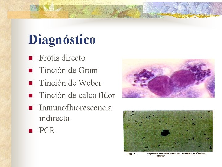 Diagnóstico n n n Frotis directo Tinción de Gram Tinción de Weber Tinción de