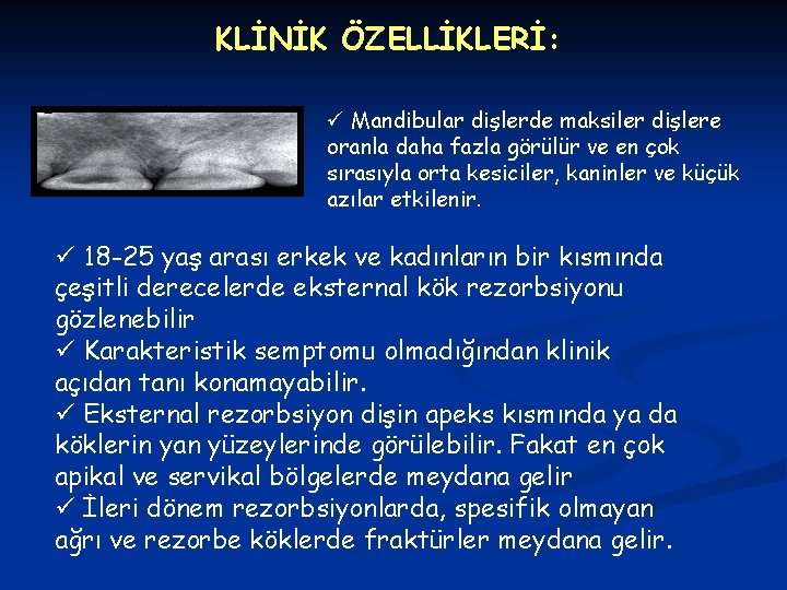 KLİNİK ÖZELLİKLERİ: ü Mandibular dişlerde maksiler dişlere oranla daha fazla görülür ve en çok