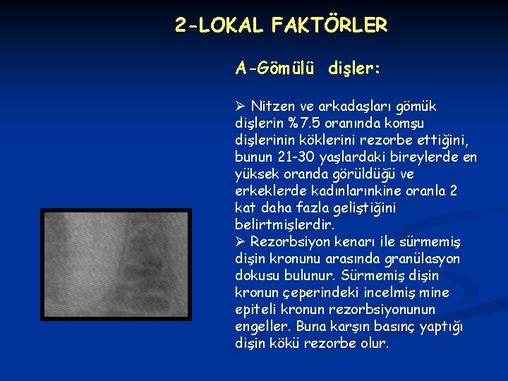 2 -LOKAL FAKTÖRLER A-Gömülü dişler: Ø Nitzen ve arkadaşları gömük dişlerin %7. 5 oranında