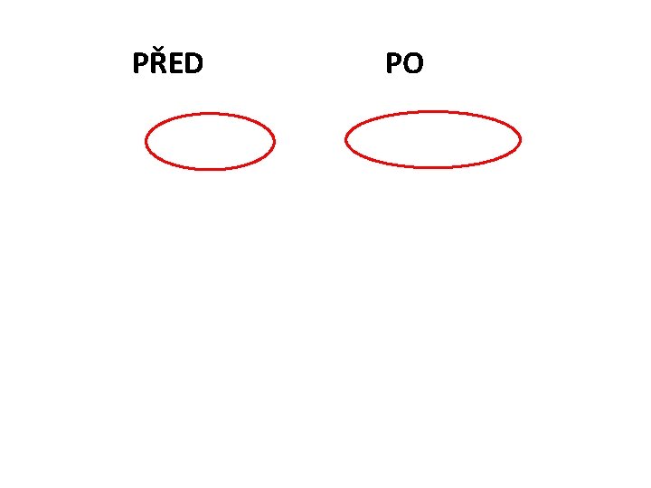 PŘED PO 