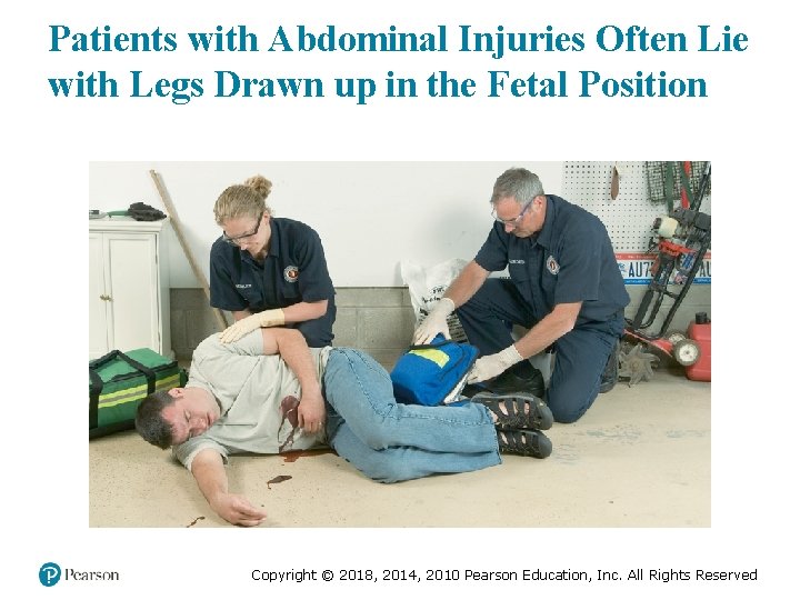 Patients with Abdominal Injuries Often Lie with Legs Drawn up in the Fetal Position