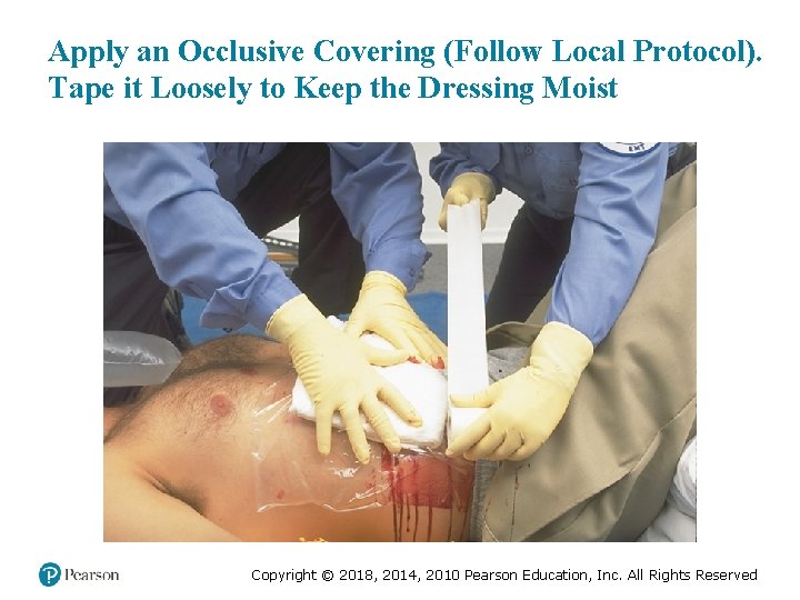 Apply an Occlusive Covering (Follow Local Protocol). Tape it Loosely to Keep the Dressing