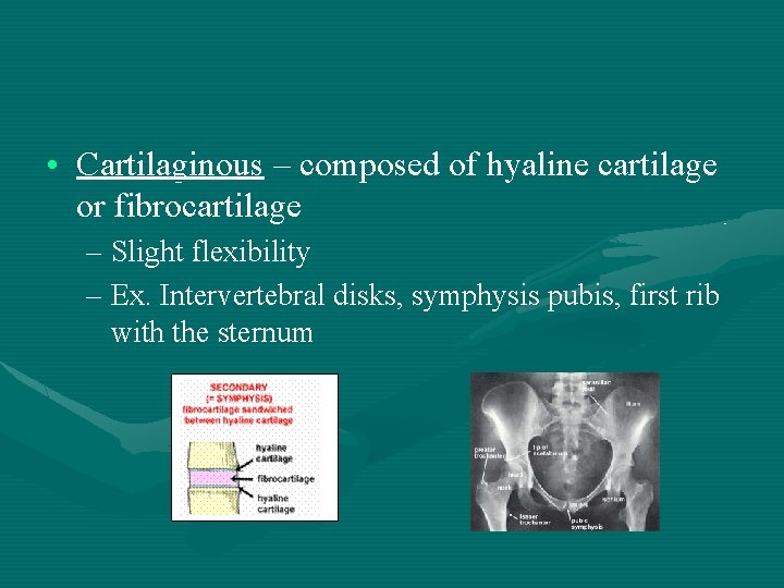 • Cartilaginous – composed of hyaline cartilage or fibrocartilage – Slight flexibility –