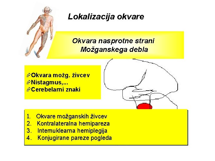 Lokalizacija okvare Okvara nasprotne strani Možganskega debla ÆOkvara možg. živcev ÆNistagmus, . . .