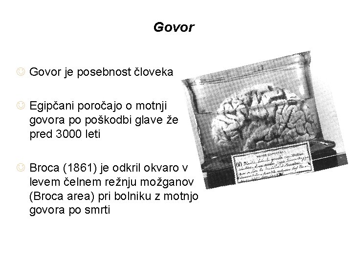 Govor J Govor je posebnost človeka J Egipčani poročajo o motnji govora po poškodbi