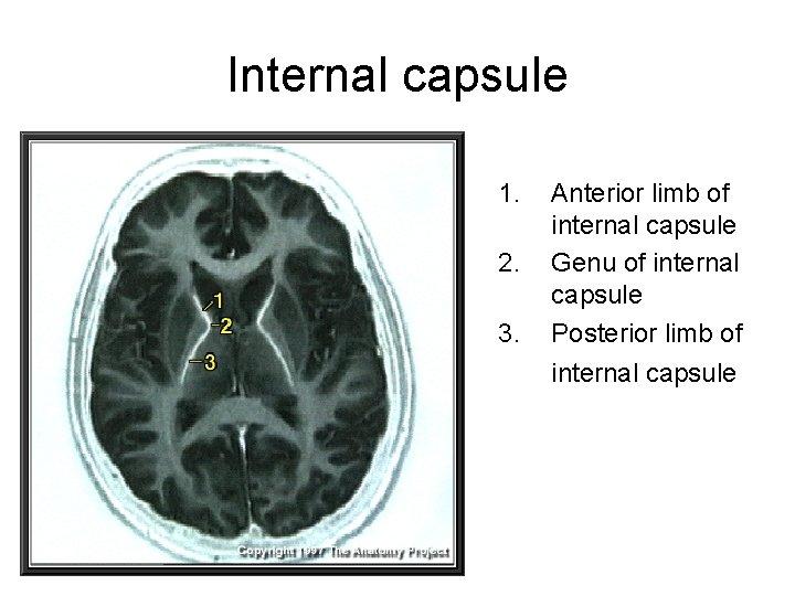 Internal capsule 1. 2. 3. Anterior limb of internal capsule Genu of internal capsule