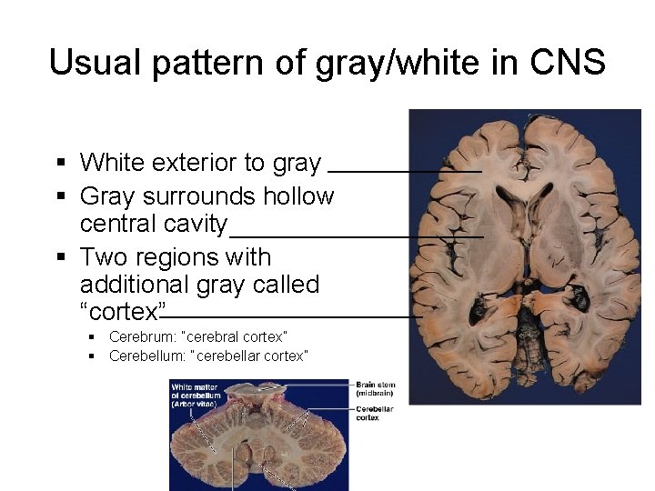 Usual pattern of gray/white in CNS § White exterior to gray _________ § Gray