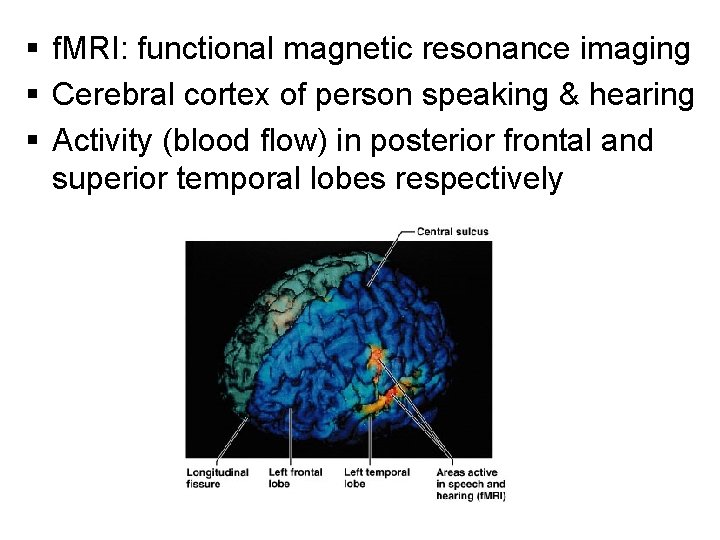 § f. MRI: functional magnetic resonance imaging § Cerebral cortex of person speaking &