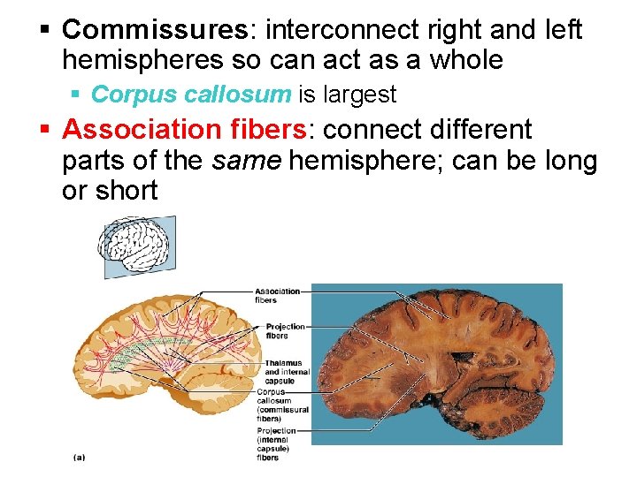 § Commissures: interconnect right and left hemispheres so can act as a whole §